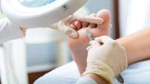 pedicure medicale forest